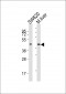 ACAT1 Antibody (C-term)